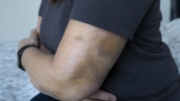 Tekort aan opvangplekken slachtoffers huiselijk geweld